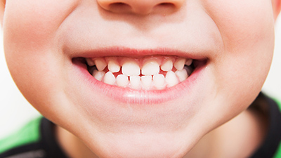 Diş gıcırdatma bir hastalık mıdır?