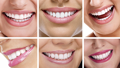 Estetik diş hekimliği nedir?